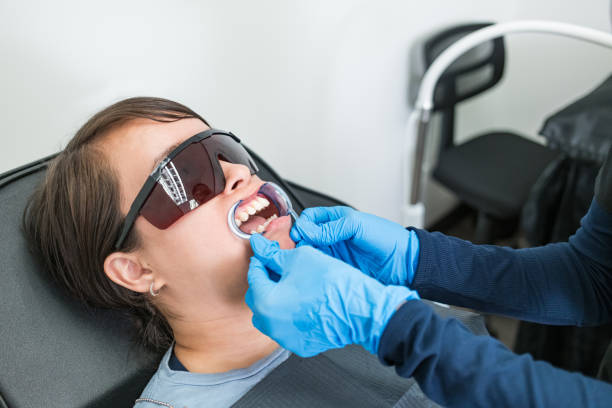 Best Knocked-Out Tooth (Avulsed Tooth) Treatment in Lakewood Ranch, FL